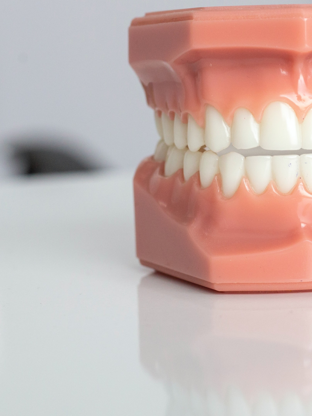 Fluorese Dentária: Desvendando as Manchas que Aparecem nos Dentes