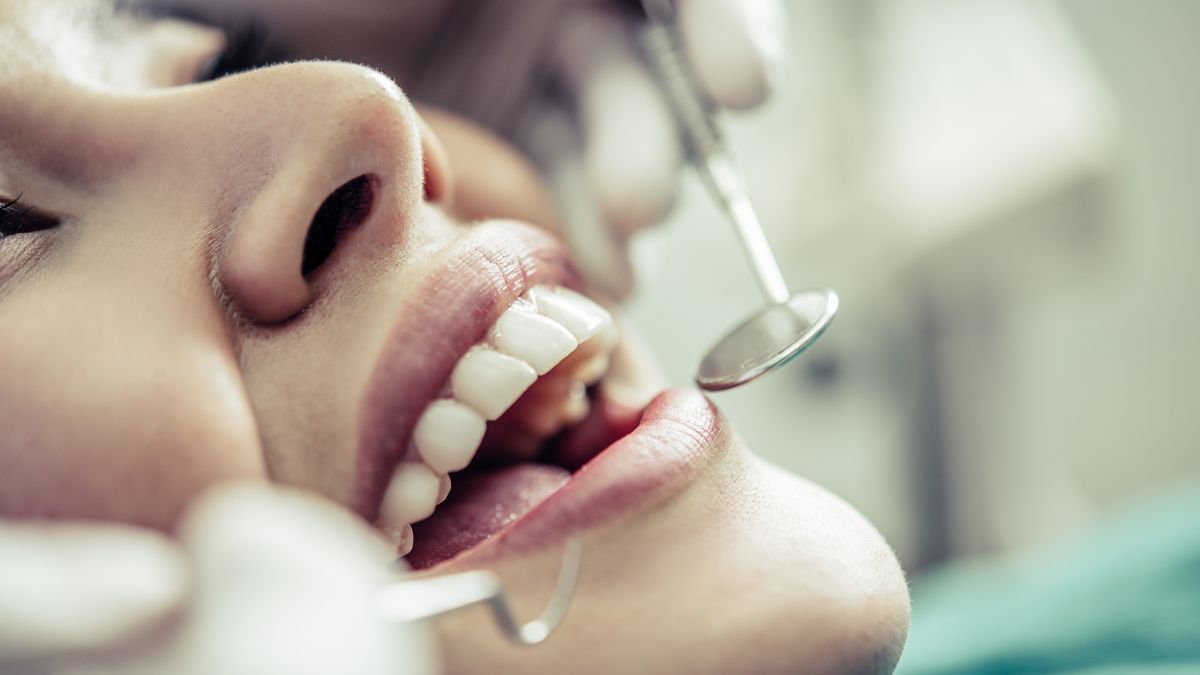 Soluções estéticas para desgaste incisal: como as lentes de contato dentais estão transformando a odontologia