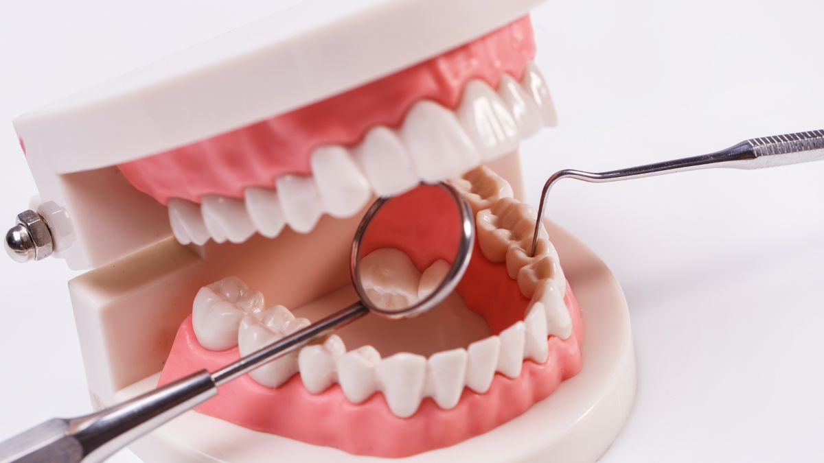 Implantes dentários vs. ortodontia: Qual é o tratamento certo para você?