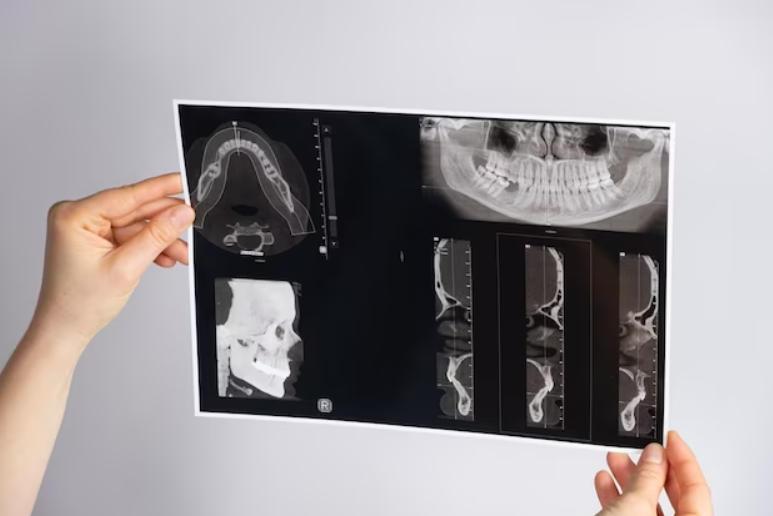 Cirurgia da ATM: Conheça os Riscos e Benefícios
