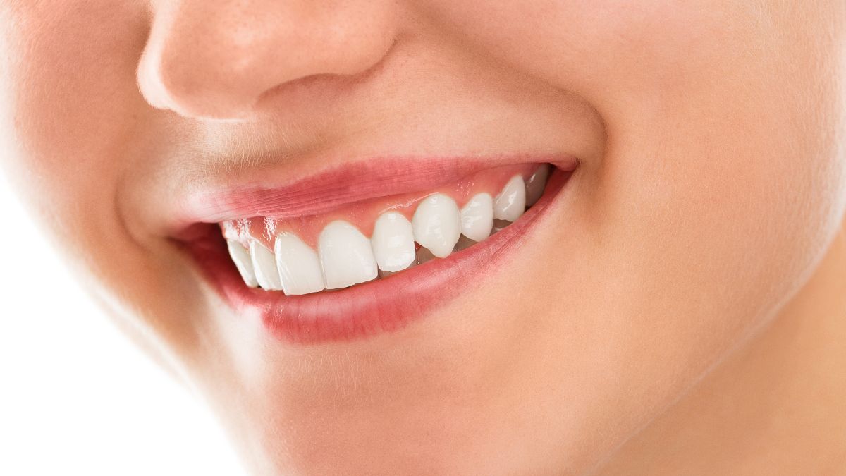 Revolucionando o tratamento odontológico: Os benefícios das lentes de contato dentais e abordagens conservadoras