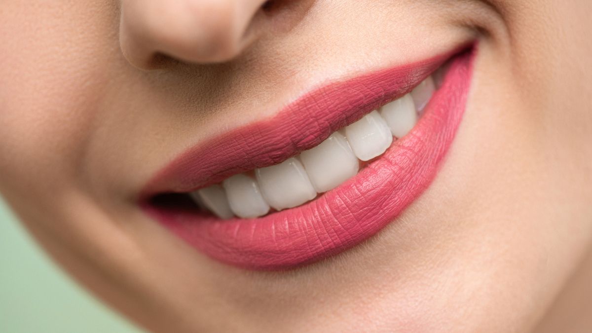 Obtenha um sorriso impecável com as lentes de contato dentais de resina: A mais recente inovação em odontologia cosmética