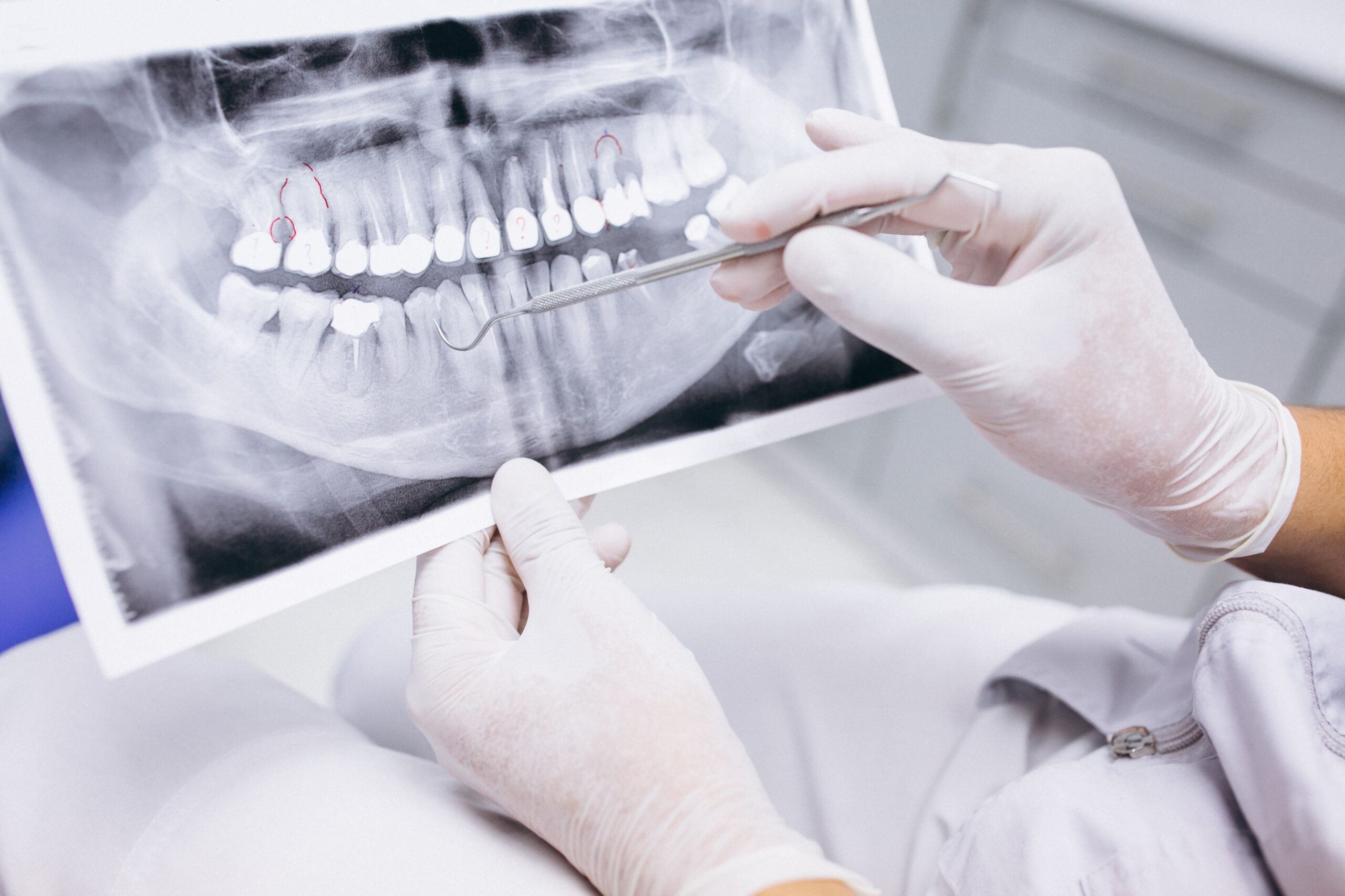 Qual Exame Detecta a Disfunção Temporomandibular (DTM)?