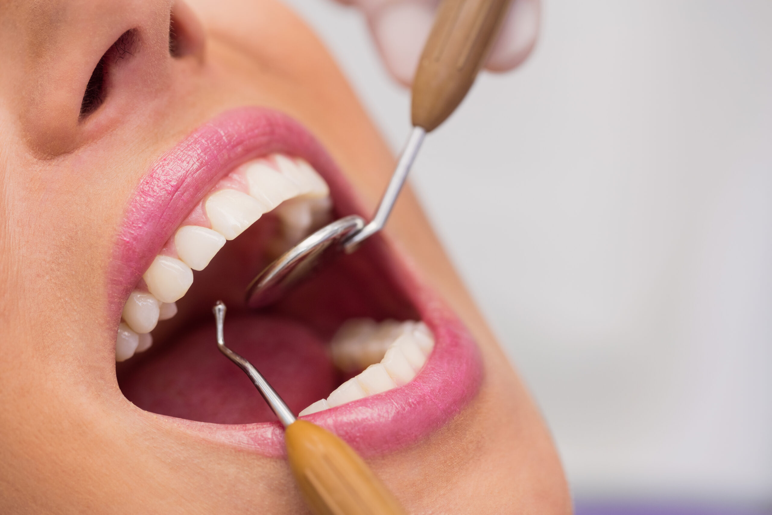 Implantes Dentários em Pacientes Fumantes: Desafios e Considerações
