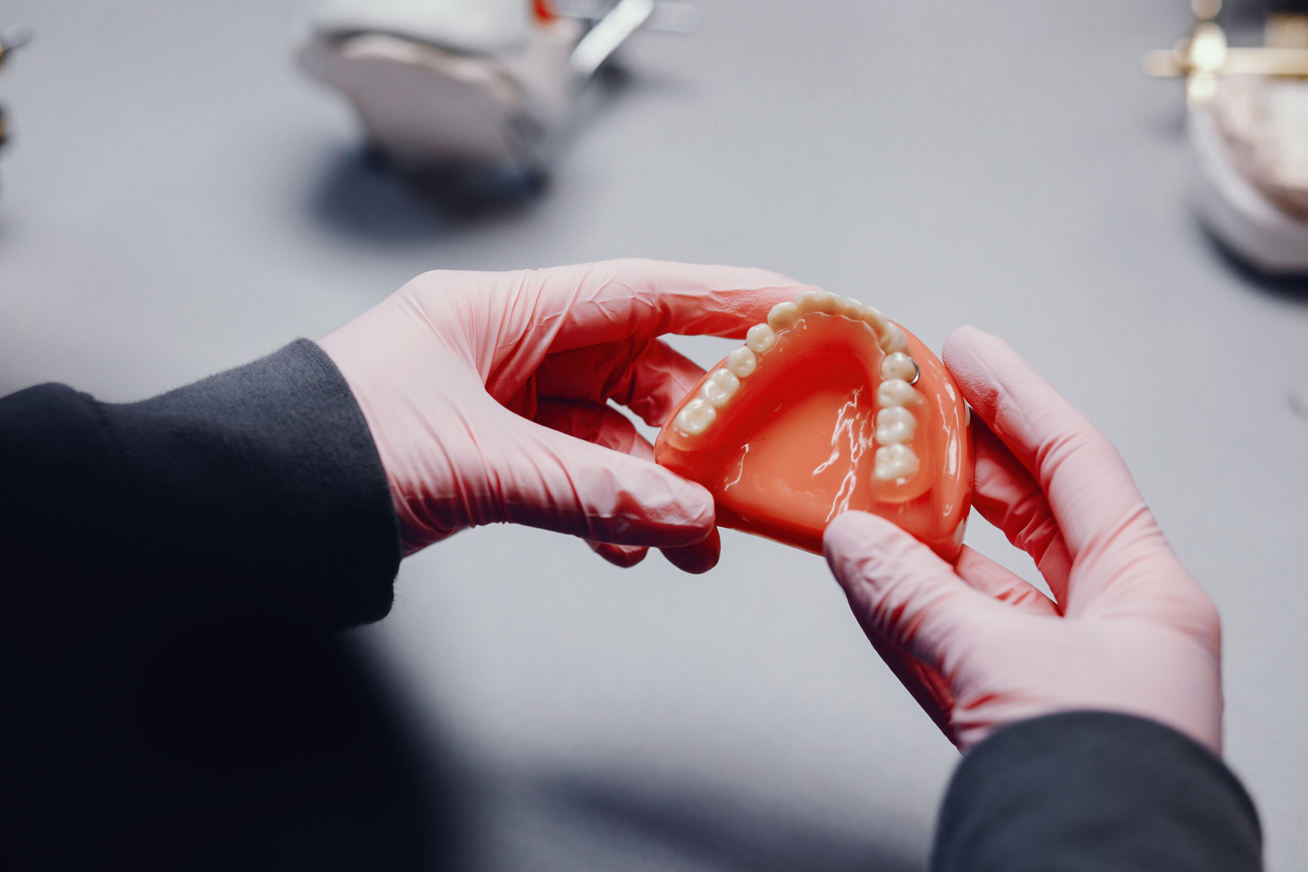 Lente de contato dental sem desgaste: tudo o que você precisa saber
