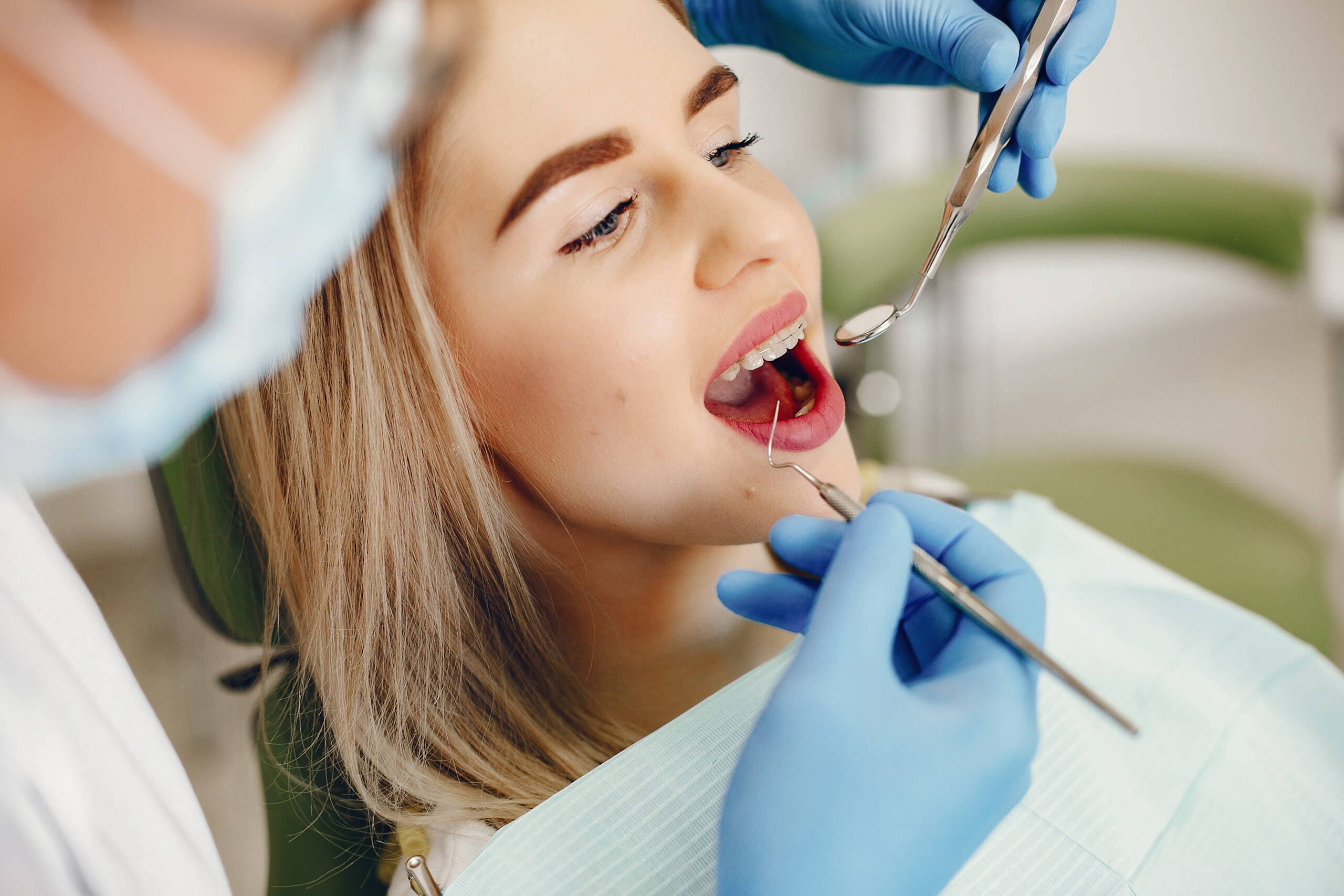 Lentes de Contato Dentais: O Passo a Passo para Transformar o Seu Sorriso