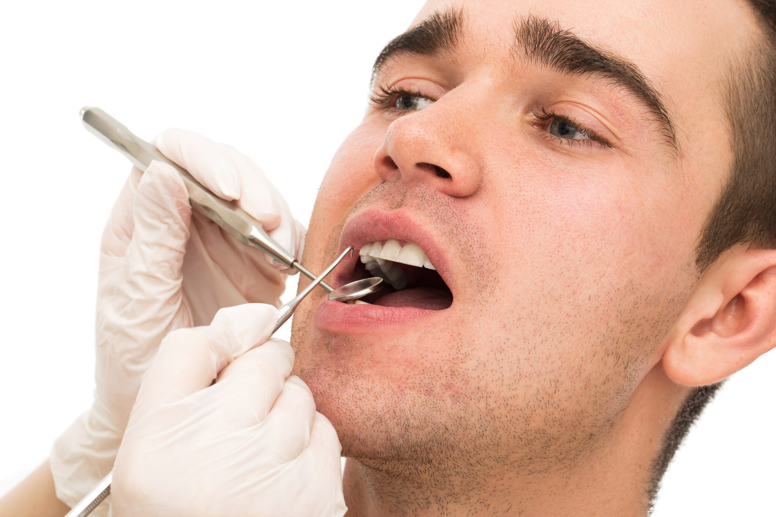 Como lidar com um caroço na mandíbula após a extração do dente do siso: O que você precisa saber